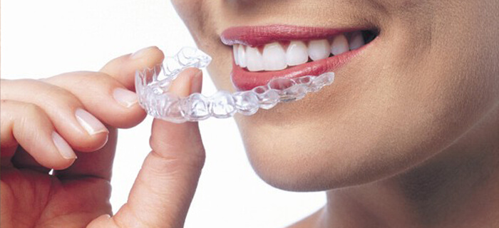 Invisalign-orthodontist